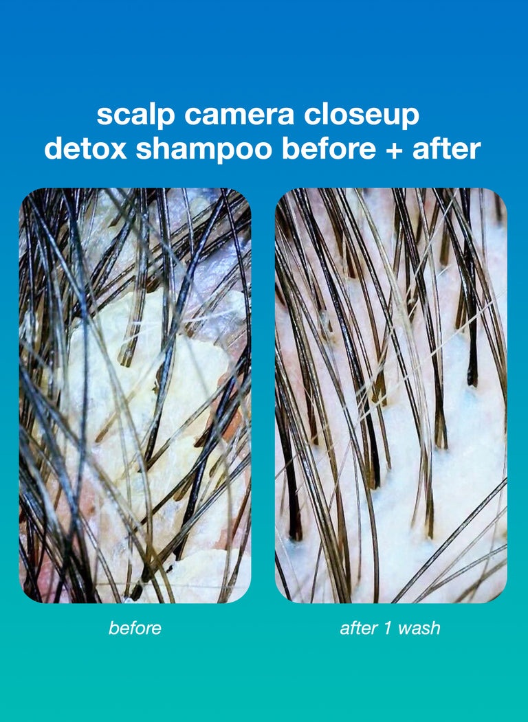 scalp-camera-closeup-detox-shampoo-before-after
