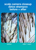 detox + repair kit