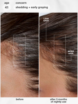 Before and after comparison of hair care product on scalp with less gray and more hair growth.