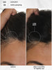 Before and after comparison of hair color with a focus on early graying.