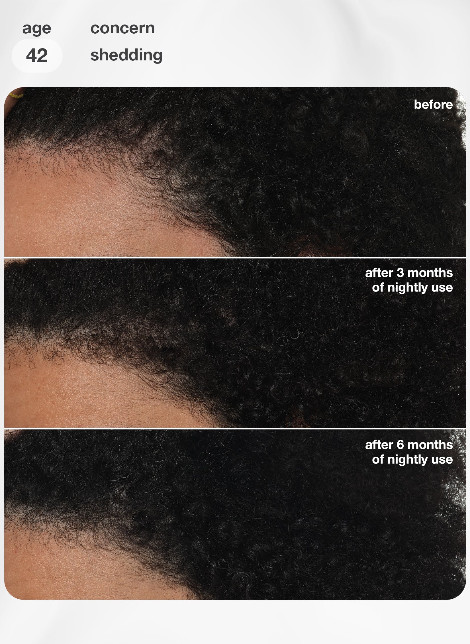 FutureIQ™ biomimetic hair longevity serum