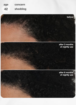 FutureIQ™ biomimetic hair longevity serum