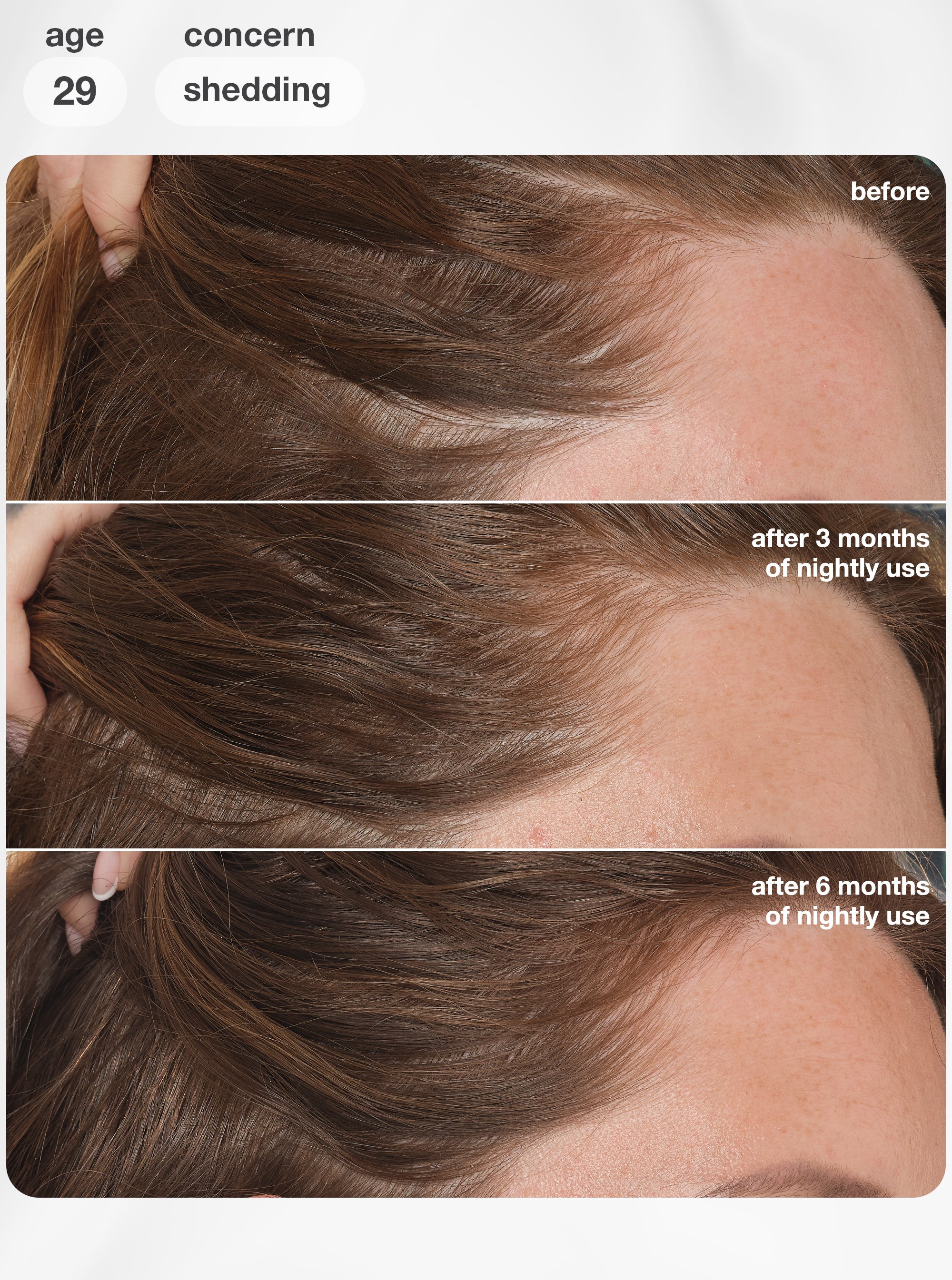 FutureIQ™ biomimetic hair longevity serum