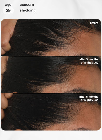 FutureIQ™ biomimetic hair longevity serum